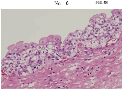 第59回午前問45画像