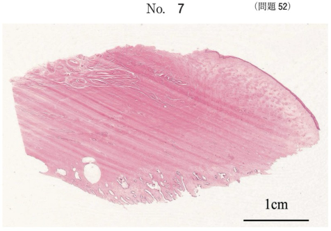 第59回午前問52画像