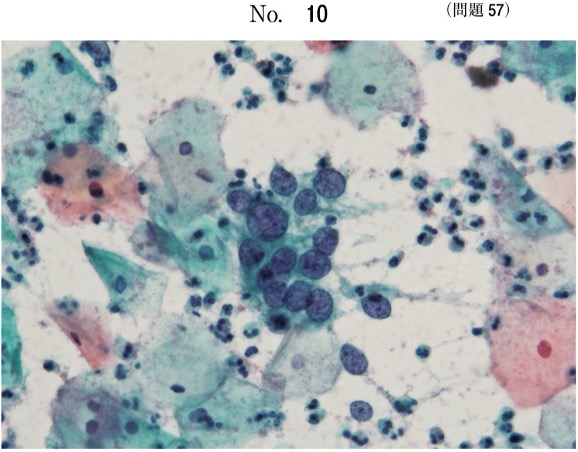 第59回午後問57画像