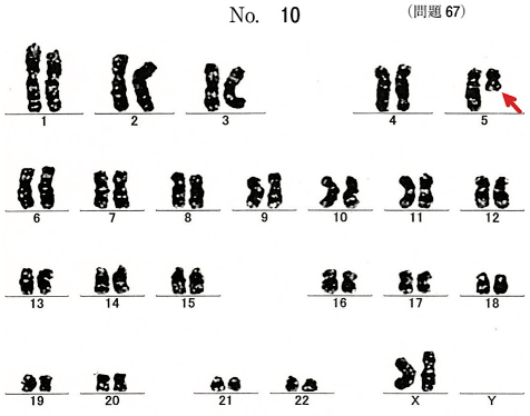 第59回午前問67画像