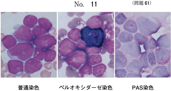 第59回午後問61画像