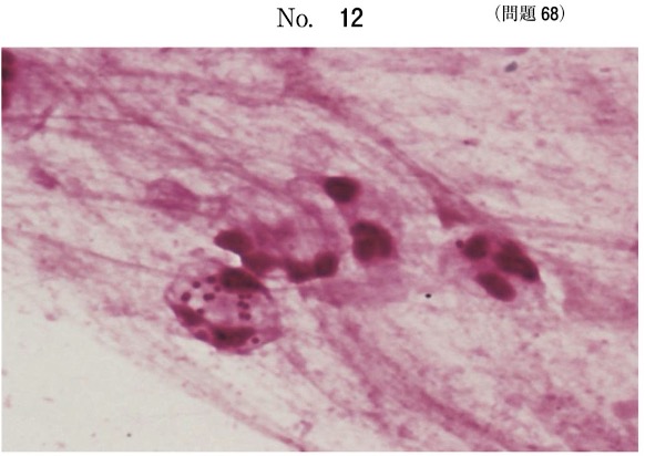 第59回午後問68画像