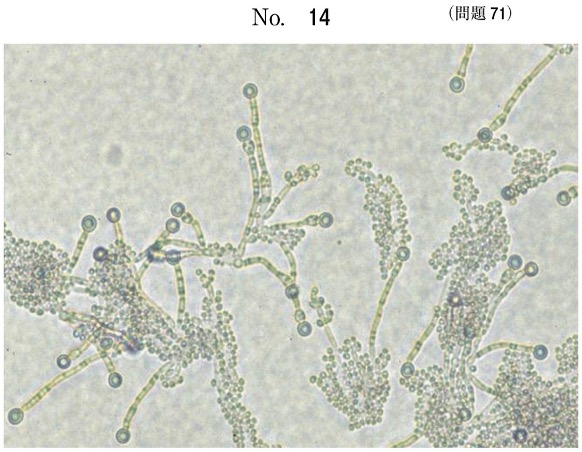 第59回午後問71画像