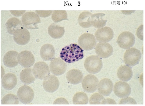 第59回午前問10画像